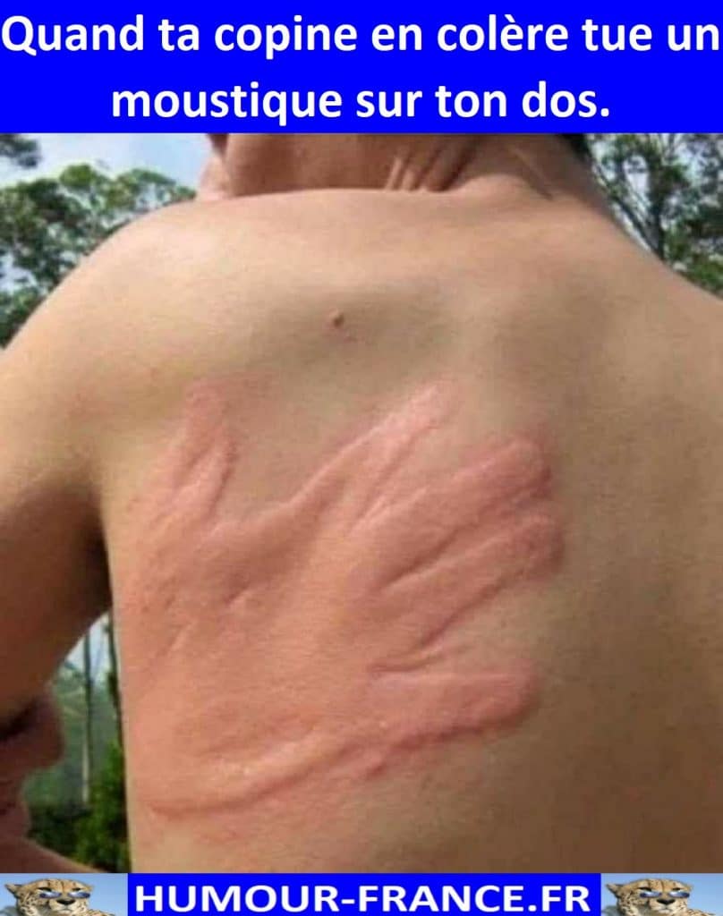 Quand ta copine en colère tue un moustique sur ton dos.