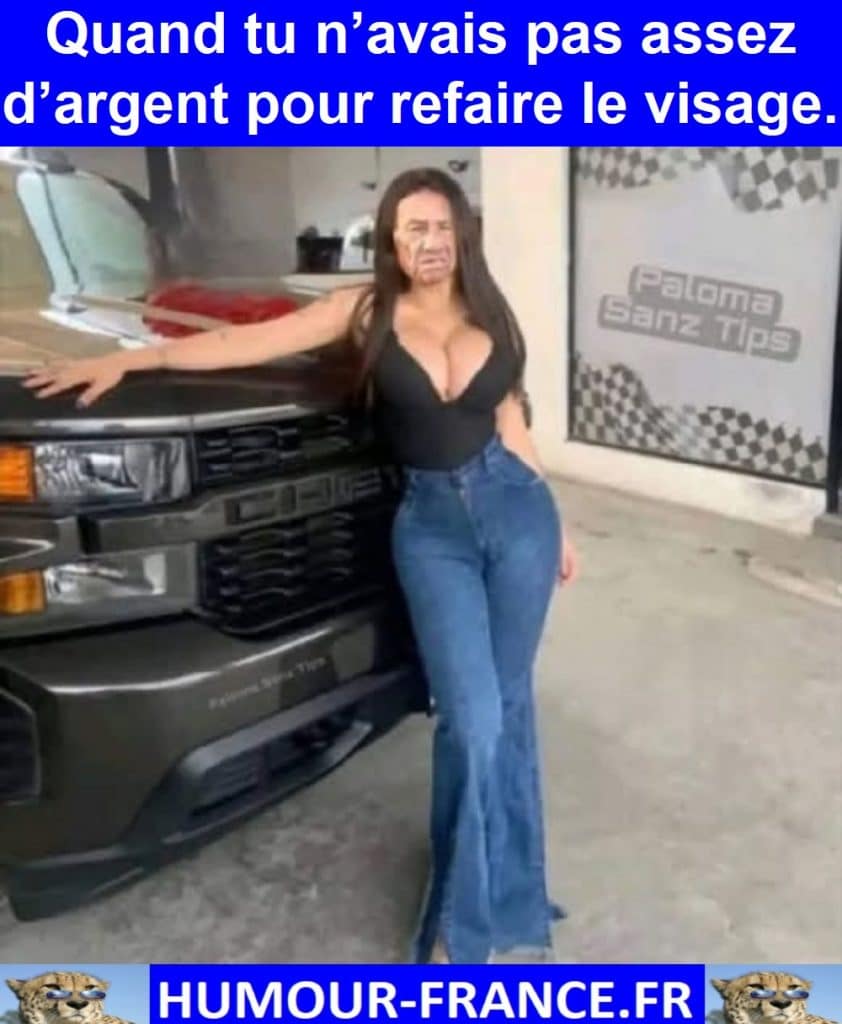 Quand tu n’avais pas assez d’argent pour refaire le visage.