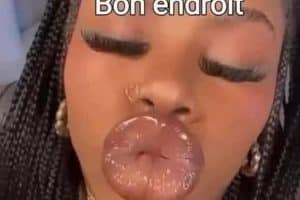 Quand l’anus n’est pas au bon endroit.