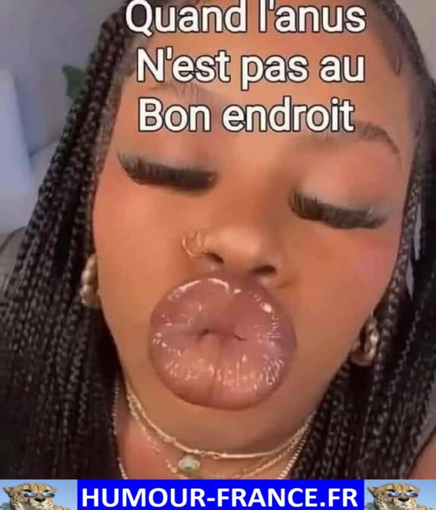 Quand l’anus n’est pas au bon endroit.